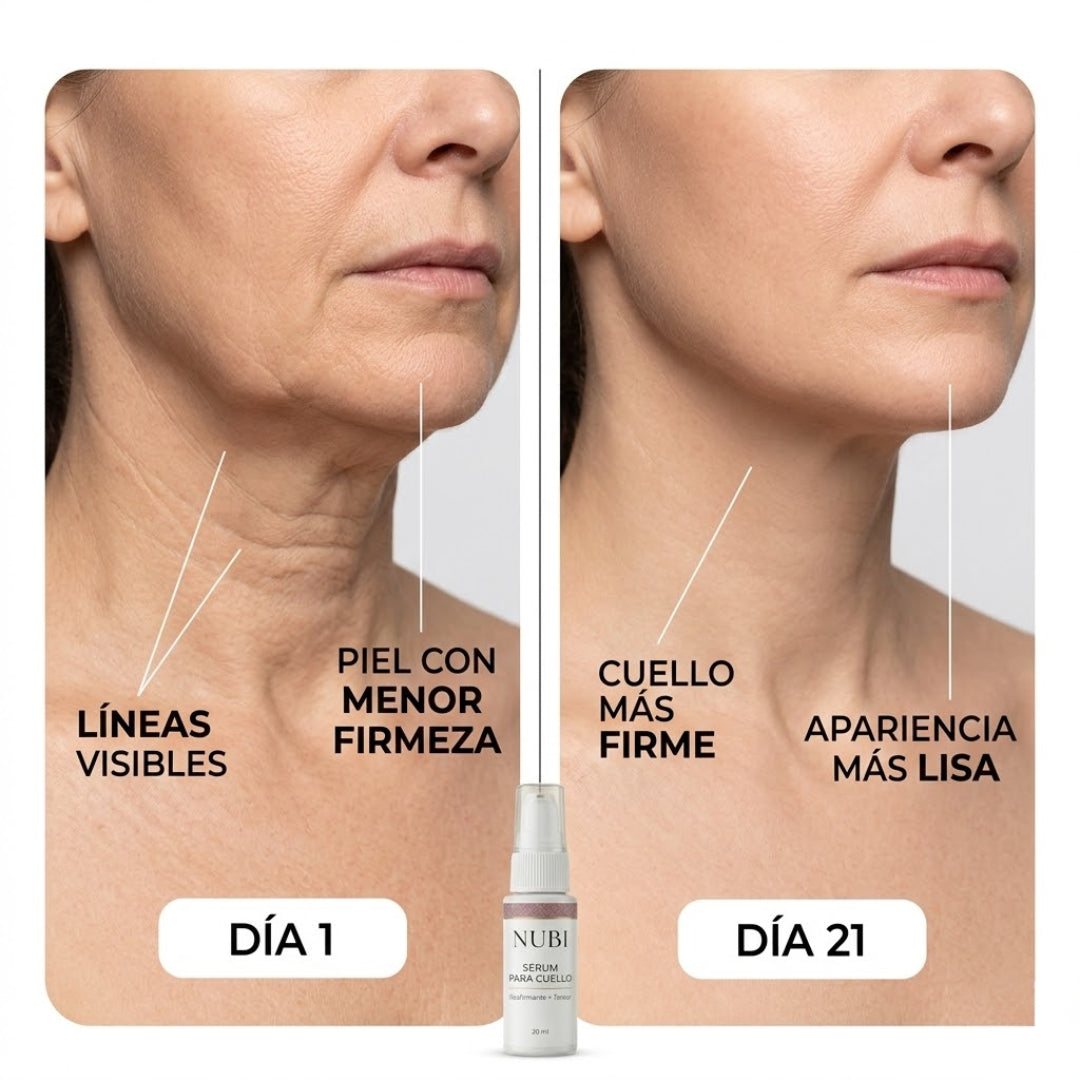 Serum NUBI® - Elimina Papada y Rejuvenece tu Cuello