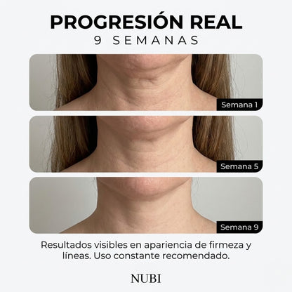 Serum NUBI® - Elimina Papada y Rejuvenece tu Cuello